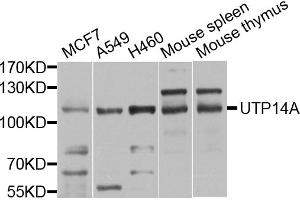 Western blot analysis of extracts of various cell lines, using UTP14A antibody (ABIN5974631) at 1/1000 dilution. (UTP14A antibody)