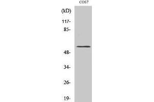 Western Blotting (WB) image for anti-Cytochrome P450, Family 4, Subfamily X, Polypeptide 1 (CYP4X1) (Internal Region) antibody (ABIN3184204) (CYP4X1 antibody  (Internal Region))