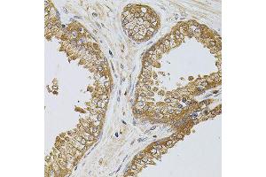 Immunohistochemistry of paraffin-embedded human prostate using TEFM antibody (ABIN5974873) at dilution of 1/100 (40x lens). (TEFM antibody)