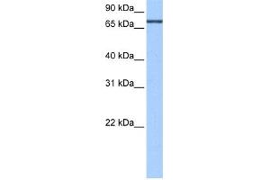 WB Suggested Anti-ADAD2 Antibody Titration:  0. (ADAD2 antibody  (C-Term))