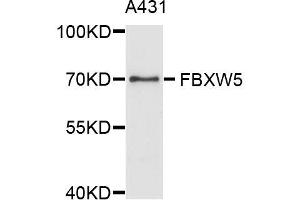 Western blot analysis of extracts of A-431 cells, using FBXW5 antibody (ABIN5996137) at 1/1000 dilution.