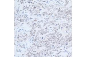 Immunohistochemistry (IHC) image for anti-Rad6 (N-Term) antibody (ABIN7449403) (Rad6 (N-Term) antibody)