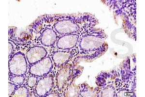 Formalin-fixed and paraffin embedded rat colitis tissue labeled with Anti-Phospho-IRAK1 (Thr209) Polyclonal Antibody, Unconjugated (ABIN742658) at 1:200 followed by conjugation to the secondary antibody and DAB staining (IRAK1 antibody  (pThr209))