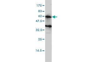 KIRREL2 monoclonal antibody (M01), clone 2B9-1D3 Western Blot analysis of KIRREL2 expression in Hela S3 NE .