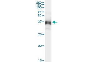 Immunoprecipitation of ACAD8 transfected lysate using anti-ACAD8 MaxPab rabbit polyclonal antibody and Protein A Magnetic Bead , and immunoblotted with ACAD8 purified MaxPab mouse polyclonal antibody (B01P) . (Acad8 antibody  (AA 1-415))