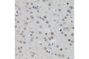 Immunohistochemistry of paraffin-embedded mouse brain using MYCN antibody. (MYCN antibody)