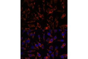 Immunofluorescence (IF) image for anti-Stromal Interaction Molecule 2 (Stim2) (AA 60-180) antibody (ABIN7270611)