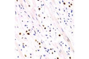Immunohistochemistry of paraffin-embedded human vermiform appendix using GEMIN2 Antibody. (SIP1 antibody)