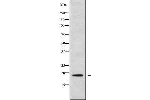 Western blot analysis of MRPL30 using HeLa whole cell lysates (MRPL30 antibody  (Internal Region))