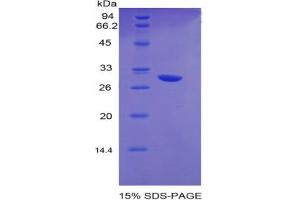 SDS-PAGE analysis of Mouse EGR2 Protein. (EGR2 Protein)