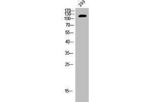 Western Blot analysis of 293 cells using EphB2 Polyclonal Antibody (EPH Receptor B2 antibody  (C-Term))