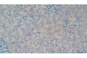 Detection of GP1BB in Rat Kidney Tissue using Polyclonal Antibody to Platelet Glycoprotein Ib Beta Chain (GP1BB) (GP1BB antibody  (AA 52-164))