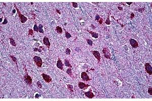 Immunohistochemistry (Formalin-fixed Paraffin-embedded Sections) (IHC (fp)) image for anti-SWI/SNF Related, Matrix Associated, Actin Dependent Regulator of Chromatin, Subfamily D, Member 2 (SMARCD2) (AA 398-475) antibody (ABIN626177)