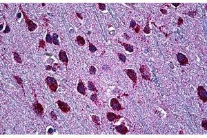 Human Brain, Cortex: Formalin-Fixed, Paraffin-Embedded (FFPE) (SMARCD2 antibody  (AA 398-475))