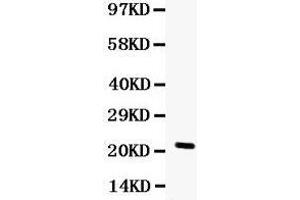 Observed bind size: 22KD (G-CSF antibody  (AA 47-208))