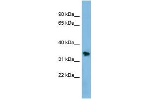 WB Suggested Anti-NSMCE1 Antibody Titration: 0. (NSMCE1 antibody  (Middle Region))