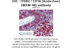 Image no. 2 for anti-Integrin beta 2 (ITGB2) antibody (ABIN1723416) (Integrin beta 2 antibody)
