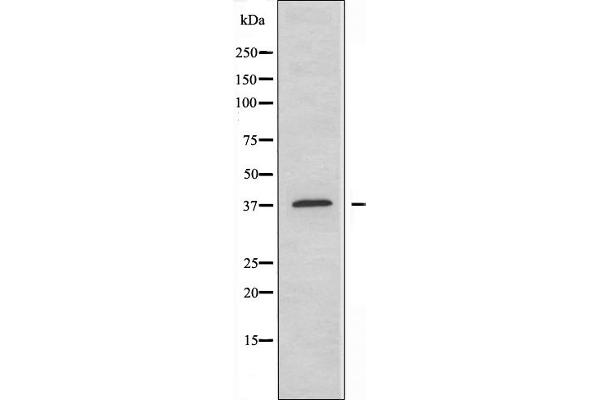 MEF2B antibody  (Internal Region)