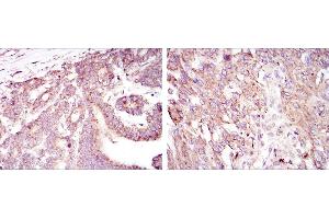 Immunohistochemistry (IHC) image for anti-Hypoxia Inducible Factor 1, alpha Subunit (Basic Helix-Loop-Helix Transcription Factor) (HIF1A) antibody (ABIN969193)