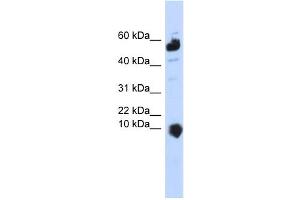 WB Suggested Anti-C1orf151 Antibody Titration:  0. (C1orf151 antibody  (Middle Region))