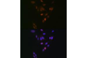 Immunofluorescence analysis of U-2 OS cells using NUP153 Rabbit mAb (ABIN1512527, ABIN3023298, ABIN3023299 and ABIN7101477) at dilution of 1:100 (40x lens). (NUP153 antibody)
