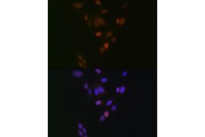 Immunofluorescence analysis of U-2 OS cells using NUP153 Rabbit mAb (ABIN1512527, ABIN3023298, ABIN3023299 and ABIN7101477) at dilution of 1:100 (40x lens). (NUP153 antibody)