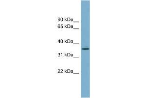 WB Suggested Anti-AWAT1 Antibody Titration:  0. (AWAT1 antibody  (N-Term))