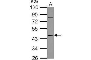 WB Image Sample (30 ug of whole cell lysate) A: A431 10% SDS PAGE antibody diluted at 1:1000 (ADK antibody)