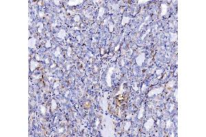 IHC analysis of SH3GL2 using anti-SH3GL2 antibody (ABIN7602229). (SH3G2 antibody  (AA 65-292))