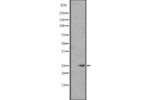 Western blot analysis of FGF8 expression in Jurkat cell lysate in RIPA buffer ,The lane on the left is treated with the antigen-specific peptide. (FGF8 antibody  (Internal Region))