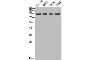 Western blot analysis of HepG2 K562 Hela Colo using ADAMTS-2 antibody. (Adamts2 antibody  (AA 1140-1211))