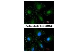 ICC/IF Image Immunofluorescence analysis of paraformaldehyde-fixed HeLa, using Calpain-5, antibody at 1:100 dilution. (Calpain 5 antibody)