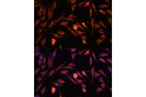 Immunofluorescence analysis of L929 cells using PTCD1 antibody (ABIN7269203) at dilution of 1:100. (PTCD1 antibody  (AA 435-537))