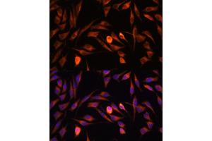 Immunofluorescence analysis of L929 cells using PTCD1 antibody (ABIN7269203) at dilution of 1:100.