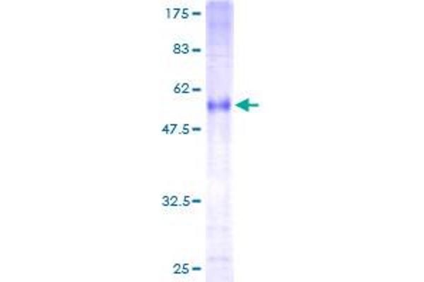 RNF144A Protein (AA 1-292) (GST tag)
