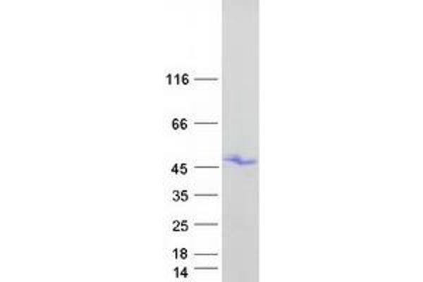 HOXB1 Protein (Myc-DYKDDDDK Tag)
