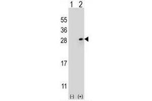 Western blot analysis of FGF9 (arrow) using rabbit polyclonal FGF9 Antibody (N-term) . (FGF9 antibody  (N-Term))