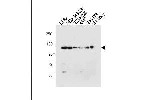 ROR1 antibody