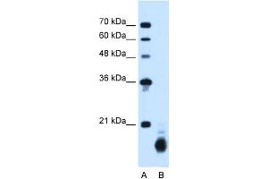 WB Suggested Anti-PPIB Antibody Titration:  1. (PPIB antibody  (C-Term))