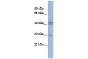 Image no. 1 for anti-CCAAT/enhancer Binding Protein (C/EBP), delta (CEBPD) (C-Term) antibody (ABIN6742779) (CEBPD antibody  (C-Term))