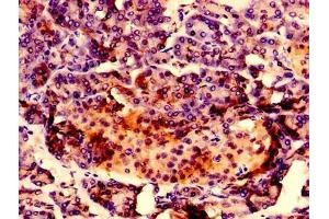 Immunohistochemistry of paraffin-embedded human pancreatic tissue using ABIN7167217 at dilution of 1:100 (RAB1A antibody  (AA 1-196))