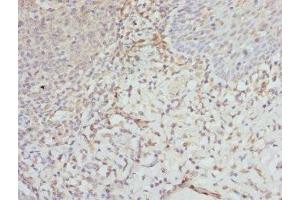 Immunohistochemistry of paraffin-embedded human tonsil tissue using ABIN7152135 at dilution of 1:100 (EIF2S3 antibody  (AA 173-472))