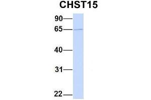 Host:  Rabbit  Target Name:  CHST15  Sample Type:  MCF7  Antibody Dilution:  1. (CHST15 antibody  (Middle Region))