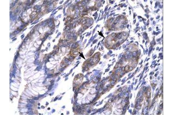 TAB2 antibody  (N-Term)