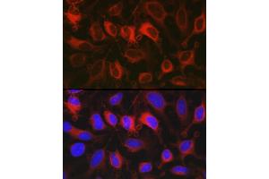 Immunofluorescence analysis of HeLa cells using G6PD Rabbit pAb (ABIN3022094, ABIN3022095, ABIN3022096 and ABIN6218601) at dilution of 1:100 (40x lens).
