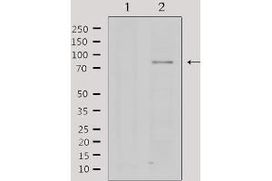 Western Blotting (WB) image for anti-Protein Arginine Methyltransferase 5 (PRMT5) (Internal Region) antibody (ABIN6266359)