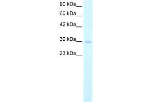 WB Suggested Anti-MSX1 Antibody Titration: 2. (MSX1 antibody  (Middle Region))