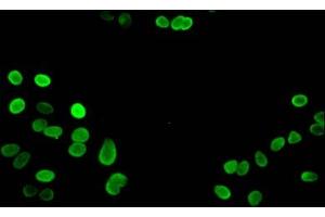 Immunofluorescent analysis of Hela cells using ABIN7139668 at dilution of 1:100 and Alexa Fluor 488-congugated AffiniPure Goat Anti-Rabbit IgG(H+L) (HIST1H3A antibody  (3meLys27))