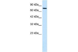 WHSC1 antibody used at 1. (WHSC1 antibody  (N-Term))
