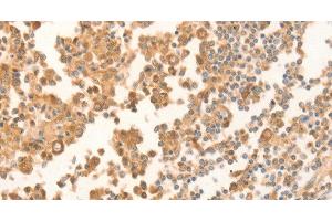 Immunohistochemistry of paraffin-embedded Human tonsil using NAP1L1 Polyclonal Antibody at dilution of 1:70 (NAP1L1 antibody)